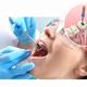 جراحی ریشه دندان و کشیدن آن چگونه انجام می‌شود؟